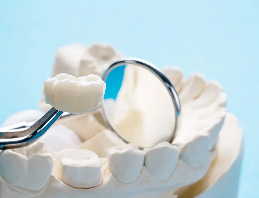 Dental Crowns in Garden Grove, CA