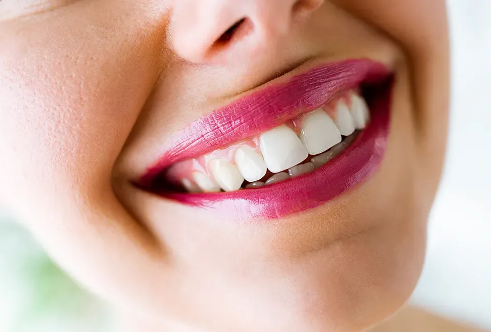 Smile Makeover in Garden Grove, CA