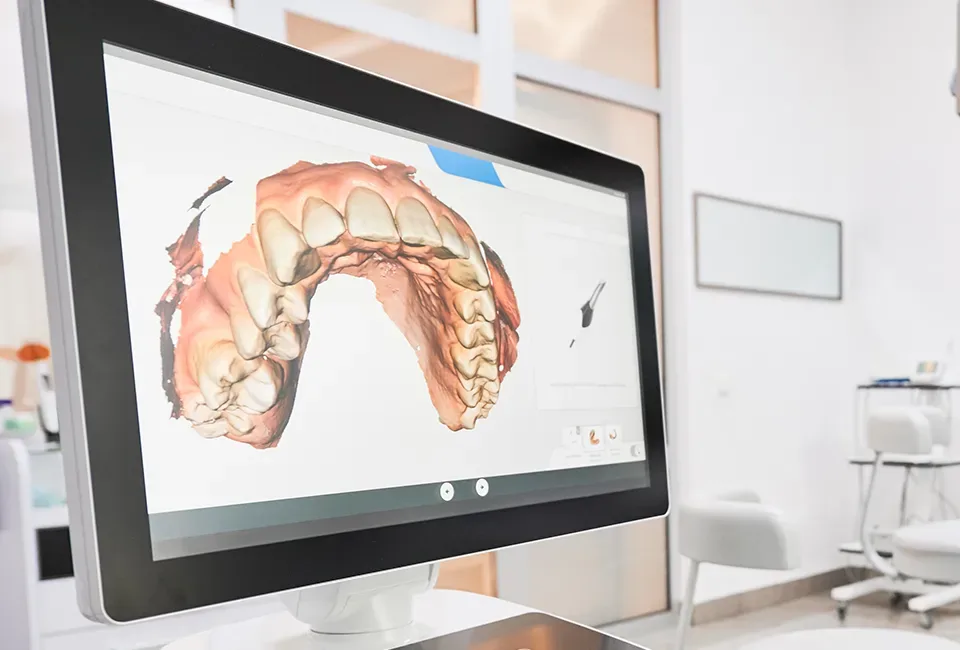 A 3D scan of the upper teeth displayed on a large monitor in a treatment room