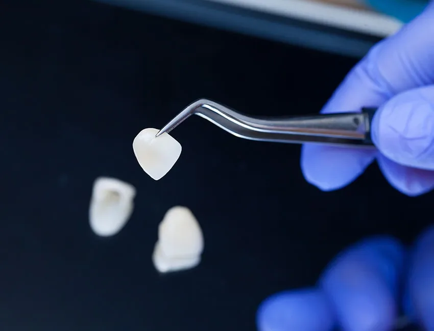 Porcelain Veneers in Garden Grove, CA