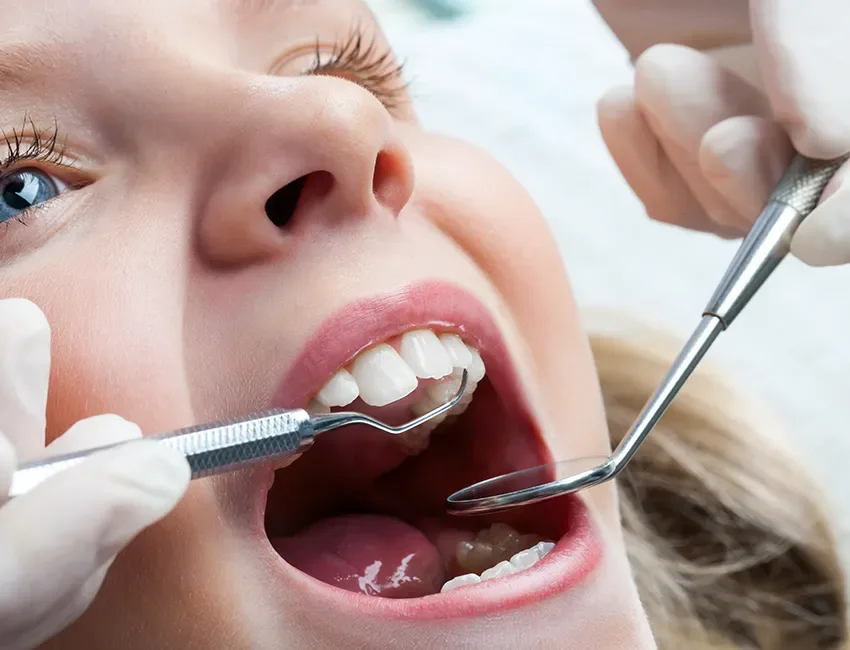 Dental Sealants in Garden Grove, CA