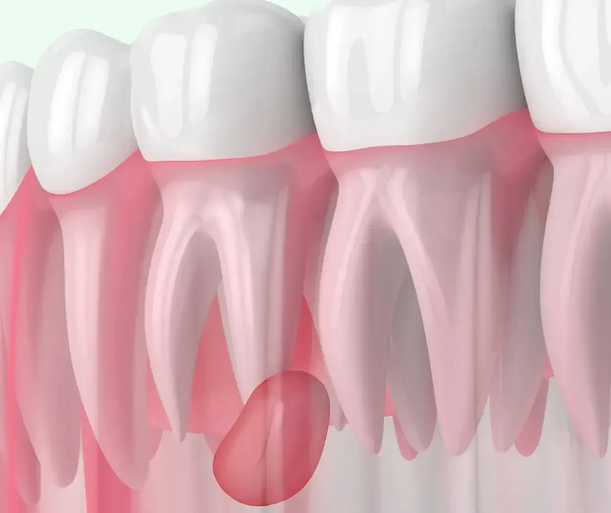 Root Canal Retreatment in Garden Grove, CA