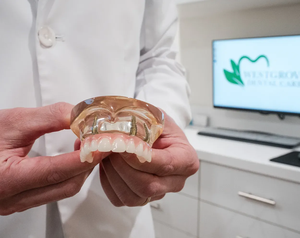 What is All-on-4 Dental Implants