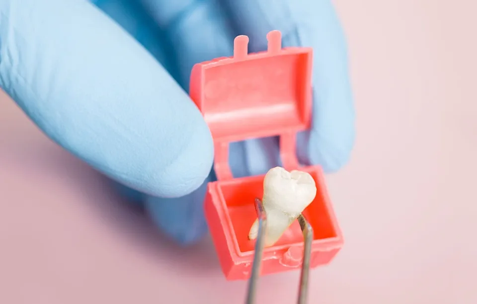 Tooth Extraction in Garden Grove, CA